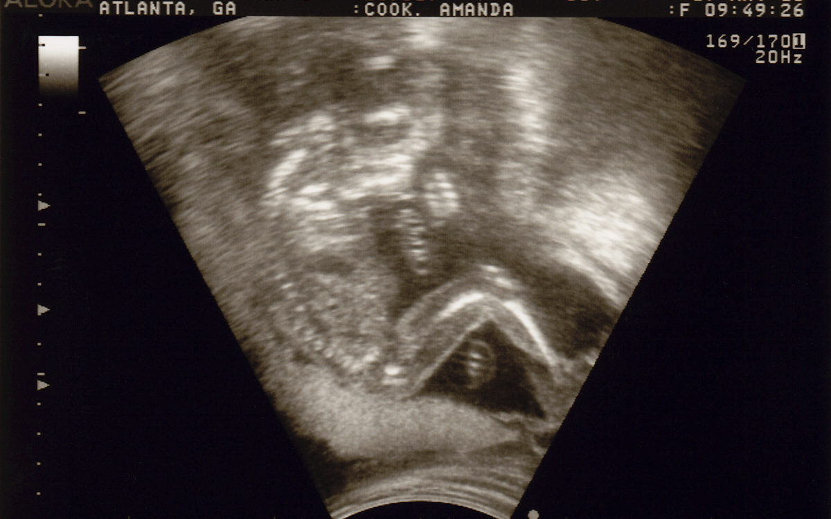 It’s a Boy – No Doubt About It!